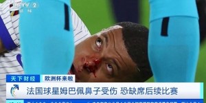 【大发体育】央视财经报道欧洲杯：法国球星姆巴佩鼻子受伤，恐缺席后续比赛，大发助力你的致富之路！